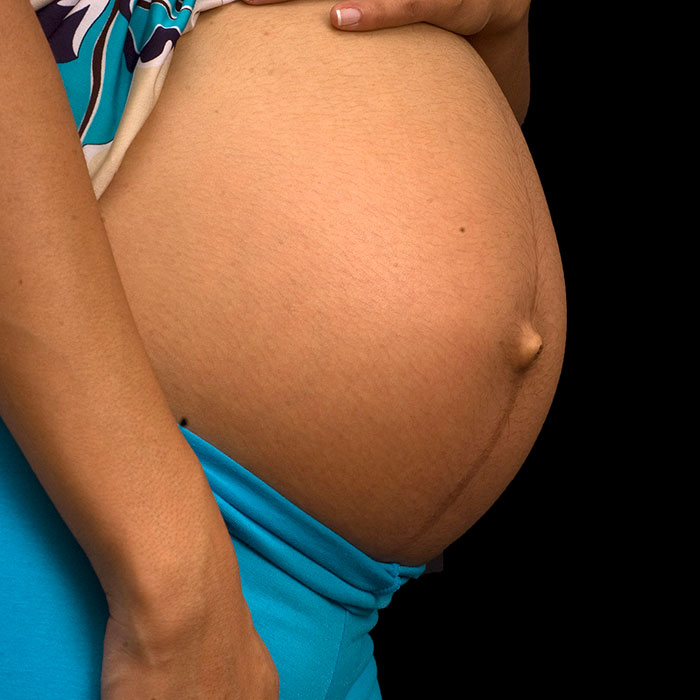 Линия на животе во время беременности